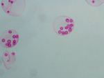 MISSING THUMBNAIL